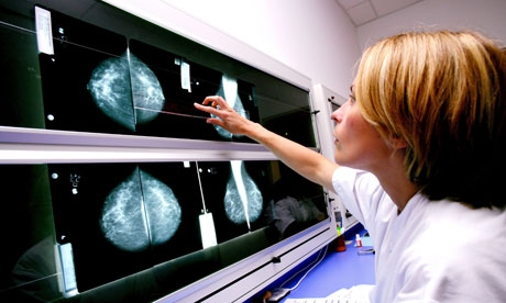 Médica avalia um exame de mamografia, capaz de detectar o câncer de mama em estágios precoces.